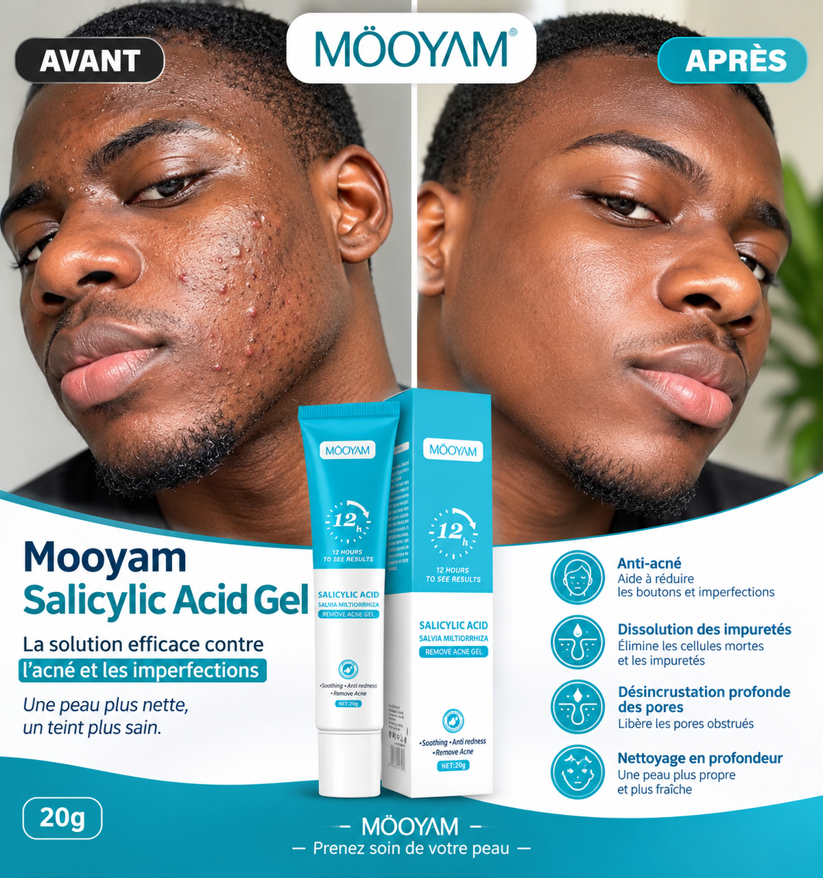 MOoyam Salicylic Acid Gel 20 g